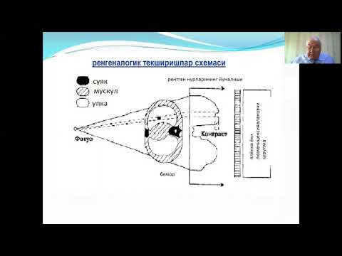 Video: Bir Rentgen Laboratoriyası Texnikinin Peşəsi Zərərli Sayılırmı?