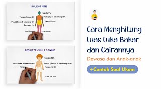 Cara Menghitung Luas Luka Bakar & Cairannya | Video Animasi