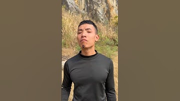 How I Cured a Bug Bite with Yogurt in the Wild | Survival Hacks 🤢🤧 #shortsvideo