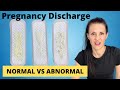 Pregnancy Discharge | Vaginal Discharge During Pregnancy | WHAT TO KNOW
