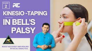 KINESIOTAPING TECHNIQUES FOR BELL'S PALSY PATIENT : LEARN TAPING TO RECOVER FACIAL MOVEMENTS
