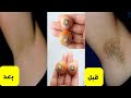 حبة جبارة/أقوى من الليزر/لإزالة شعر العانة والجسم كله نهائيا بلا عودة في5 دقائق وتبييض البشرة 4درجات