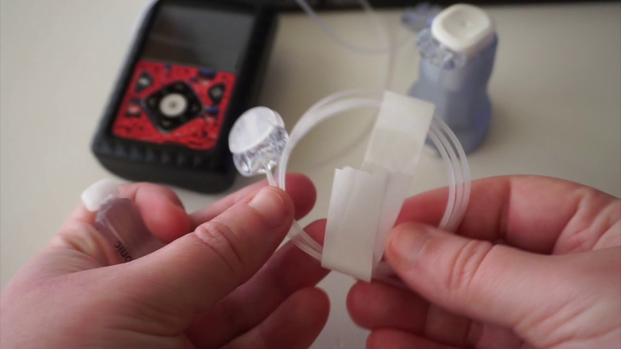 Cambio cánula Mio Advance con 780G