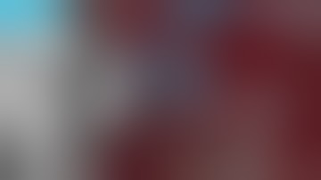 Immediate implantation and lateral augmentation with cerabone® and Jason® membrane