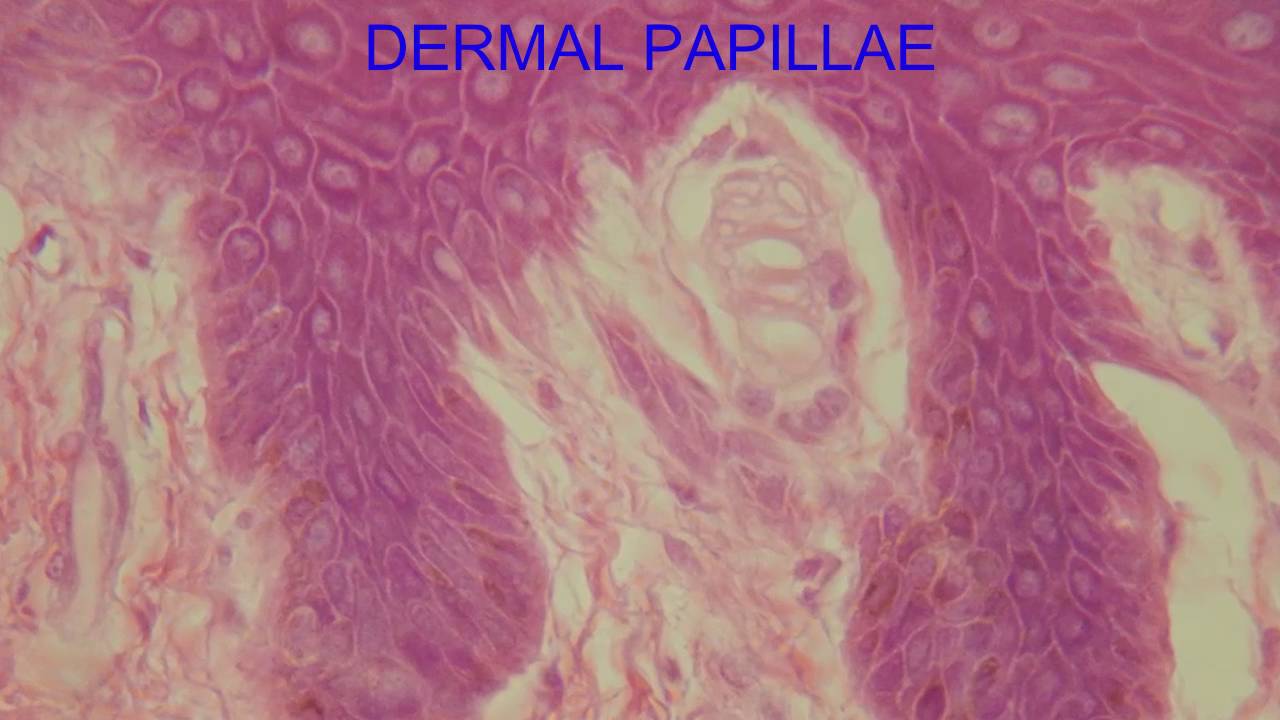 Dermal Papillae Histology