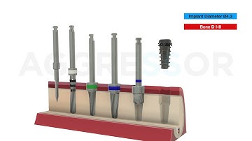 Surgical Protocol of 4.3 mm Aggressor Implant in Type I or Type II Bone