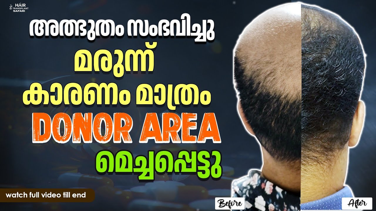 With Proof, Miracle happened within 4 months 👌