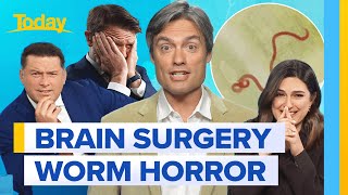Live worm found in Aussie woman’s brain has Today team SQUIRMING | Today Show Australia