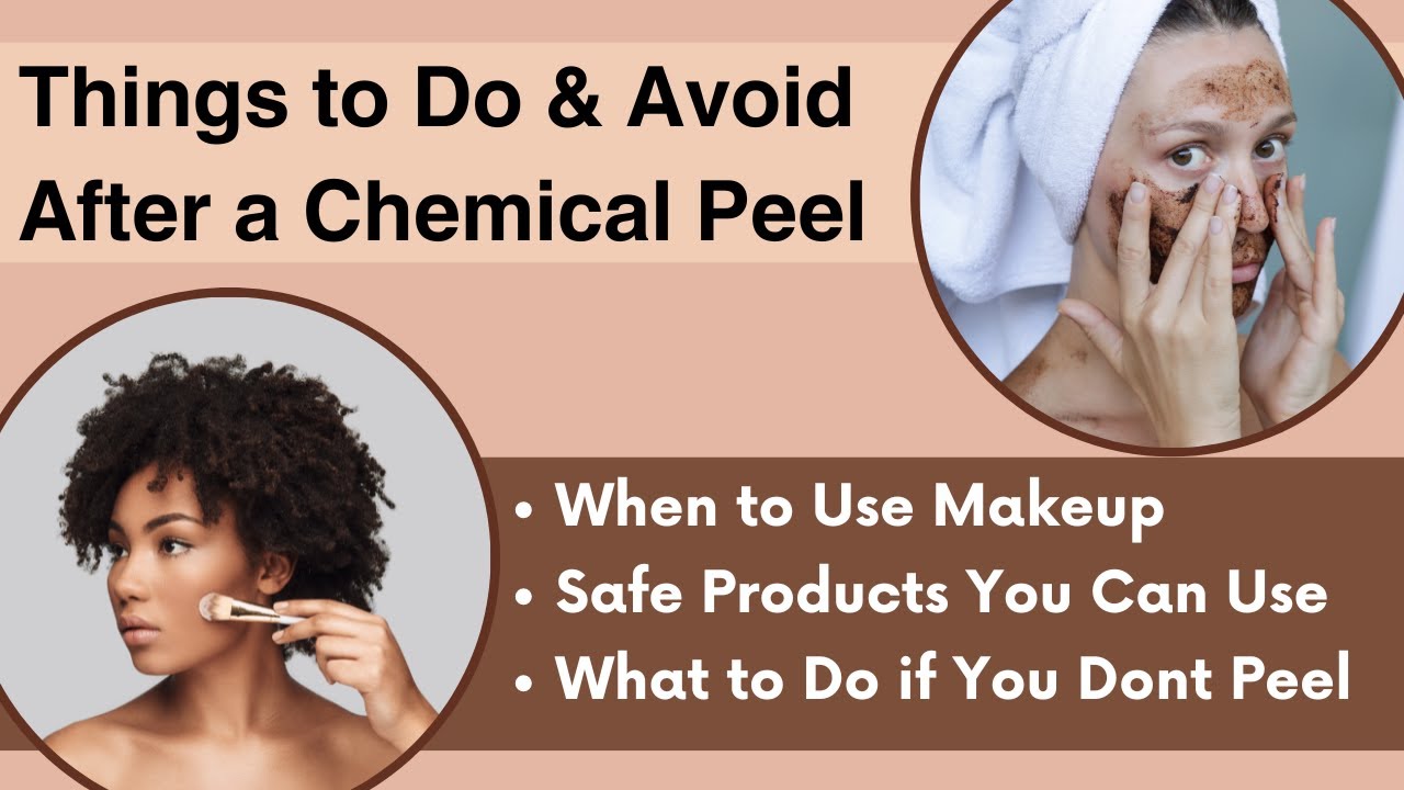 Chemical Peel Aftercare - Things to Avoid & Do