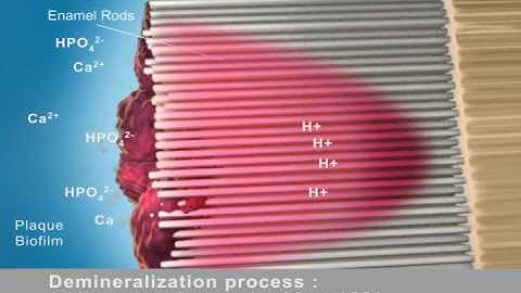 Les résines infiltrantes