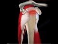 Rotator Cuff Symptoms Sleep Disorders Rotator Cuff Symptoms Sleep Disorders