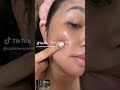 Acne Defense Gel