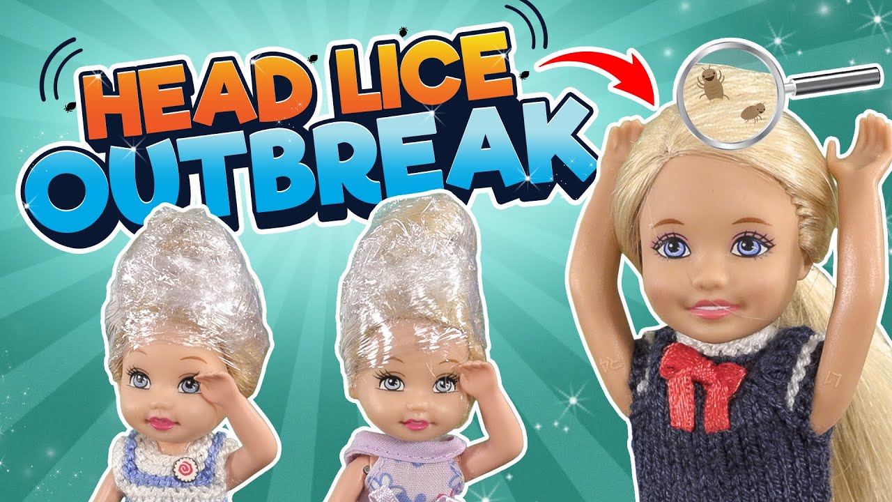 Barbie The Head Lice Outbreak Ep.332 YouTube