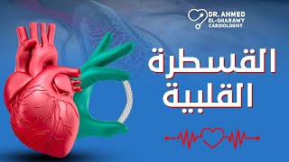 قسطرة القلب | الحل المثالي لسرعة التشخيص والعلاج لأمراض القلب