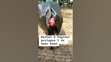 Rectal & Vaginal prolapse l dr Umar khan