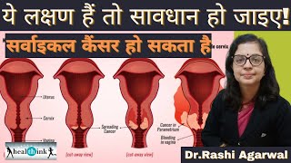 सर्वाइकल कैंसर के शुरुआती लक्षण और उसका इलाज।Early symptoms & treatment of Cervical cancer।Healthink screenshot 5