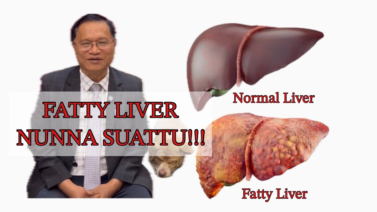 FATTY LIVER - NUNNA SUATTU