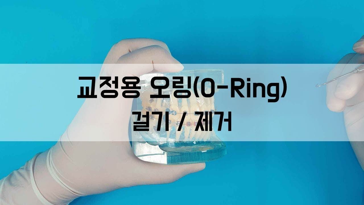 교정용 오링(O-RING) 걸기 / 제거 - 치과위생사 실습 실기 ! 치과굿잡!