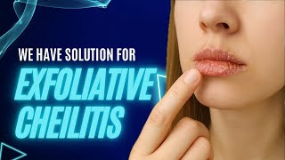 Exfoliative Cheilitis Exfoliative Cheilitis Success Stories