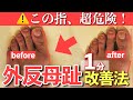 【1分、親指を動かすだけ】外反母趾の治し方
