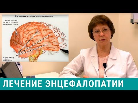 Энцефалопатия - лечение головного мозга, симптомы энцефалопатии