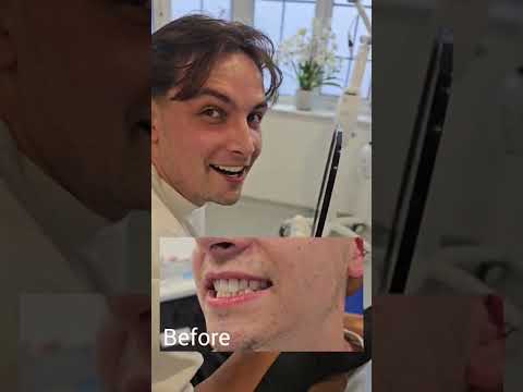 Patient story — Dentures