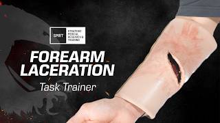 Addressing Extremity Lesions with the SMRT™ Forearm Laceration