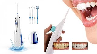 جهاز تنظيف الأسنان بالماء - المميزات والعيوب وطريقة الاستعمال