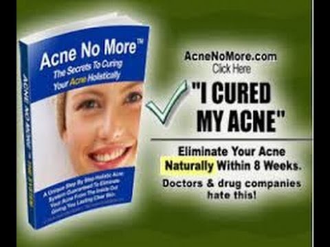 No More Acne