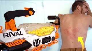 Quick Answer: Which Nerf Gun Hurts The Most - Bikehike Quick Answer: Which Nerf Gun Hurts The Most - Bikehike
