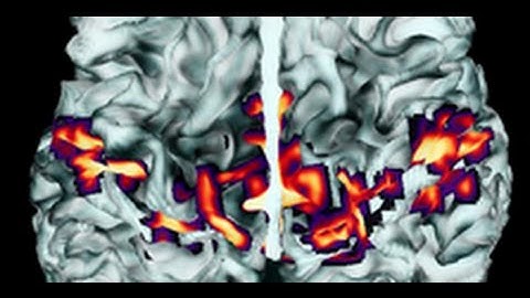 3D interactive tractography-informed resting-state fMRI connectivity