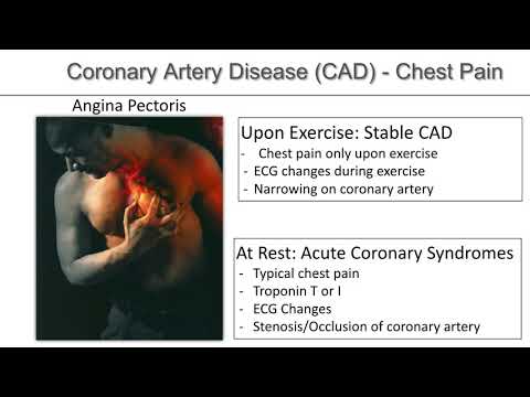 From atherosclerosis to coronary disease and infarction