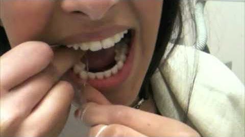 How to Floss with a Permanent Retainer Official and Original Video  ❤