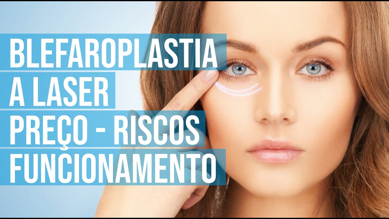 Blefaroplastia a Laser Preço, Riscos e como Funciona o Método YouTube