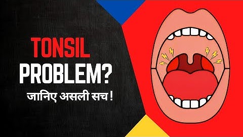 Tonsils की समस्या? कारण, लक्षण और इलाज...#tonsil #tonsilstones #tonsilsurgery #health #doctor