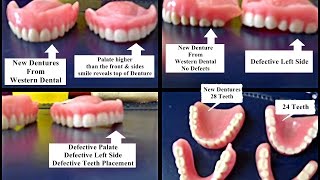 Miss Ruby Tuesday- Denture Time- Defective Dentures Vs. New Dentures