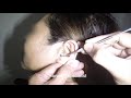 My Top 5 Woman's Earwax Removal - What's Yours?