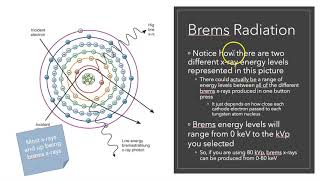 Brems x-rays Net Worth