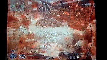 MY INTERVENTION ACOG/NO SCOPE MONTAGE