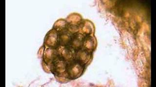 Dipylidium Caninum Documentary