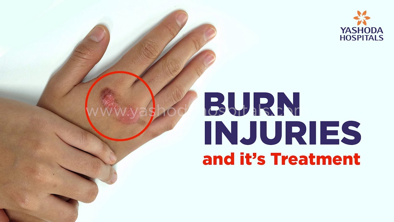 Different Types of Burn Injuries and Treatment Plastic Surgeon in