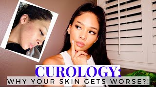 WHY CUROLOGY MAKES YOUR SKIN WORSE?! | TOP 5 TIPS FOR PURGING