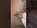 Relaxing beard hair Satisfying massage #lashes #beard #eyelashextensions #thebarbersarms #pimple