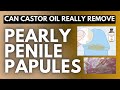 Castor Oil for Pearly Penile Papules: Truth, Myths, and Alternatives