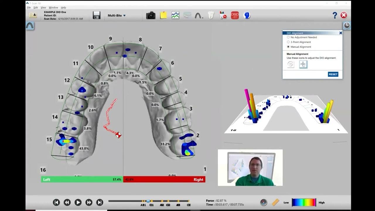 How to Use Intraoral Scanner Files in T Scan Software YouTube