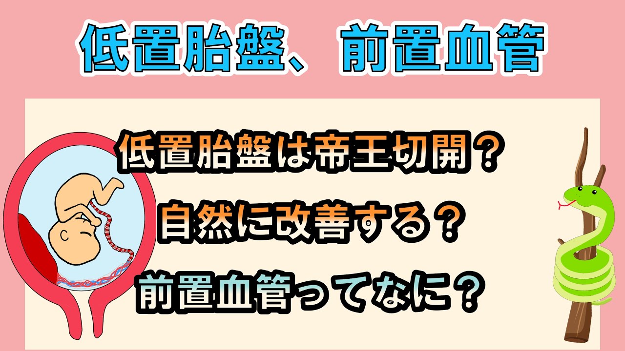 低置胎盤と診断されたら絶対に帝王切開になる?自然に改善はする?前置血管ってなに? - YouTube