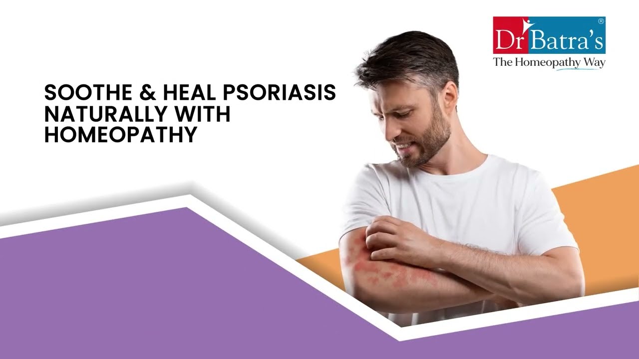 #Psoriasis