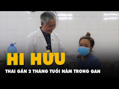 Video Thai gần 2 tháng tuổi nằm trong gan của người phụ nữ ở... - youtube