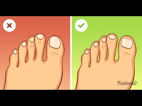 remedios naturales para la artritis 8 Consejos para lucir una pedicura digna de salón de belleza ¡sin salir de casa!