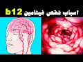 اسباب نقص فيتامين b12